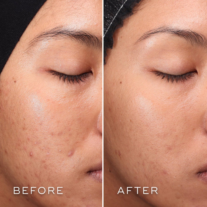 Medik8 skin care Medik8 Press & Clear