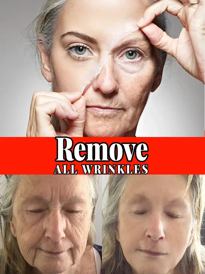 removes wrinkles,anti wrinkle serum